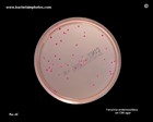 yersinia enterocolitica on CIN agar